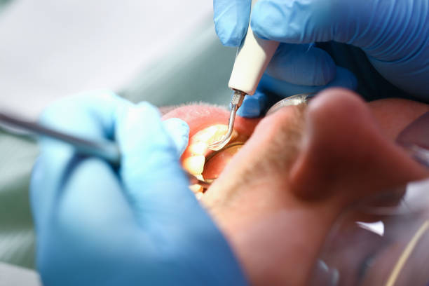 Best Dentist for Tooth Abscess  in Pierz, MN